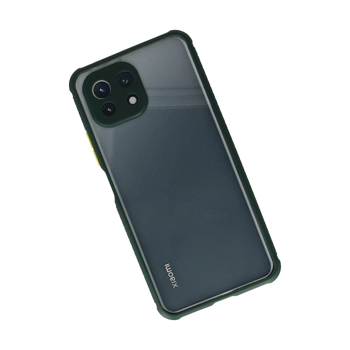 Xiaomi Mİ 11 Lite Kılıf Miami Şeffaf Silikon - Koyu Yeşil
