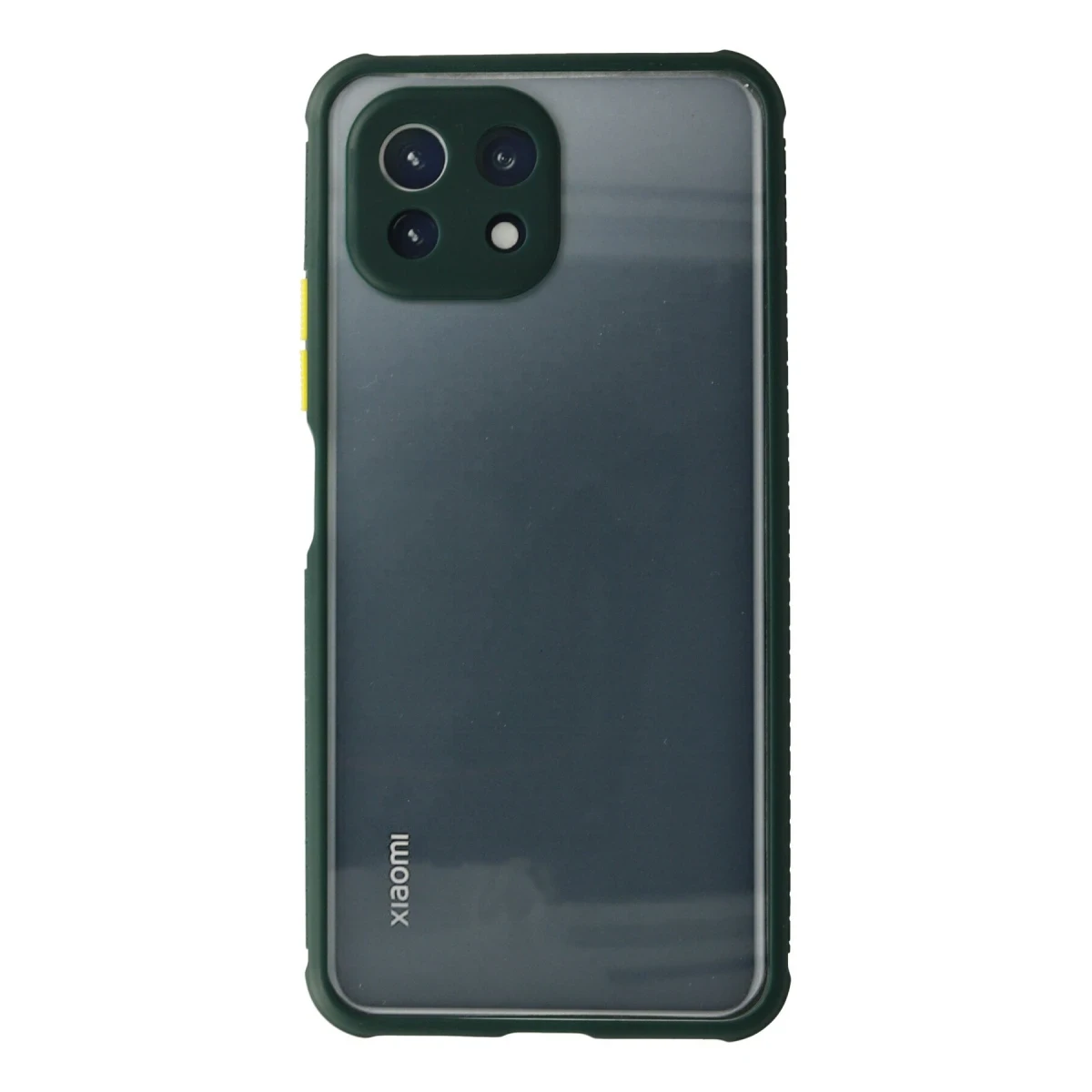 Xiaomi Mİ 11 Lite Kılıf Miami Şeffaf Silikon - Koyu Yeşil