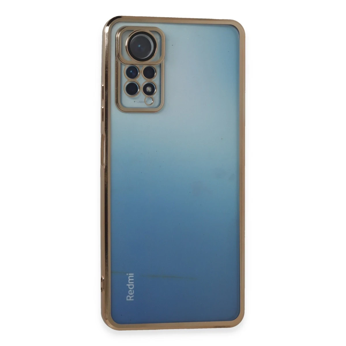 Xiaomi Redmi Note 11 Pro Kılıf Razer Lensli Silikon - Gold