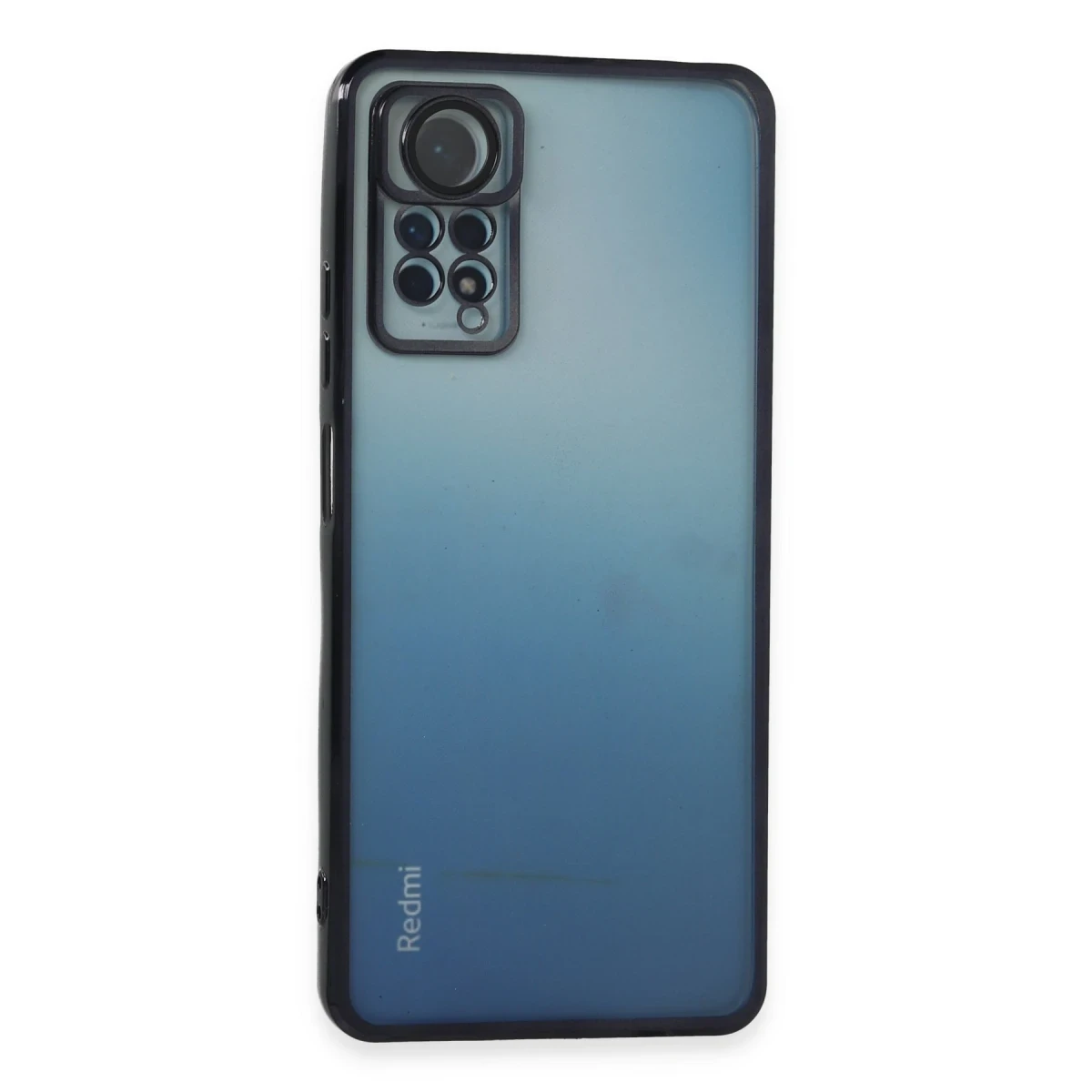 Xiaomi Redmi Note 11 Pro Kılıf Razer Lensli Silikon - Siyah